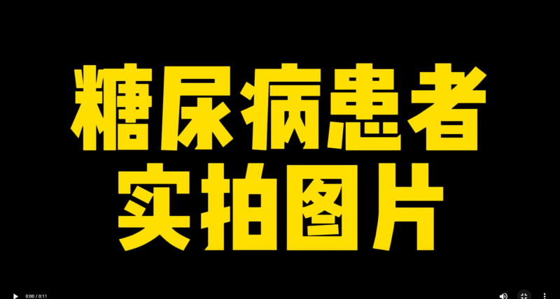 功能大米改善案例------糖尿病患者实拍图片-安食科技_AI美食机_功能大米_安食科技智慧餐饮